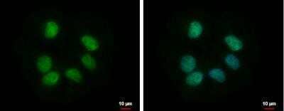 Immunocytochemistry/Immunofluorescence: RBMY1F Antibody [NBP2-15093] - NT2D1 cells were fixed in 4% paraformaldehyde at RT for 15 min. Green: RBMY1F protein stained by RBMY1F antibody diluted at 1:500. Blue: Hoechst 33342 staining. Scale bar = 10 um.