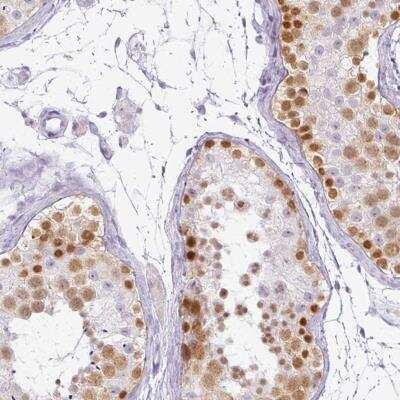 Immunohistochemistry: RBMY1F Antibody [NBP2-46812] - Staining of human testis shows strong nuclear positivity in subset of cells in seminiferus ducts.