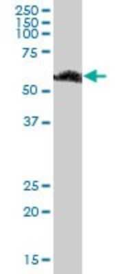 Western Blot RBMY1F Antibody - Azide and BSA Free