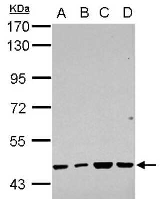 Western Blot RBMY1F Antibody