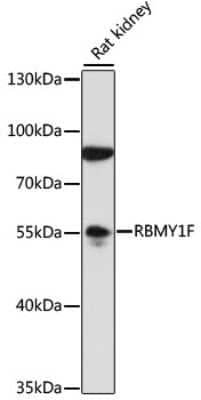 Western Blot: RBMY1F Antibody [NBP2-94712] - Analysis of extracts of rat kidney, using RBMY1F at 1:1000 dilution.Secondary antibody: HRP Goat Anti-Rabbit IgG (H+L) at 1:10000 dilution.Lysates/proteins: 25ug per lane.Blocking buffer: 3% nonfat dry milk in TBST.Detection: ECL Basic Kit .Exposure time: 1s.