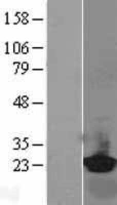 Western Blot: RBP4 Overexpression Lysate (Adult Normal) [NBL1-15228] Left-Empty vector transfected control cell lysate (HEK293 cell lysate); Right -Over-expression Lysate for RBP4.