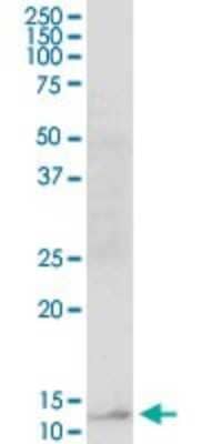 Western Blot RBP5 Antibody - Azide and BSA Free