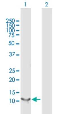Western Blot RBP5 Antibody - Azide and BSA Free