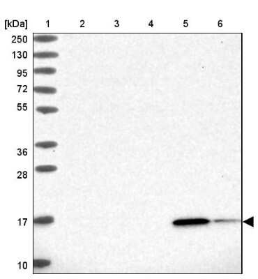 Western Blot: RBP5 Antibody [NBP2-32643] - Lane 1: Marker  [kDa] 250, 130, 95, 72, 55, 36, 28, 17, 10.  Lane 2: Human cell line RT-4.  Lane 3: Human cell line U-251MG sp.  Lane 4: Human plasma (IgG/HSA depleted).  Lane 5: Human liver tissue.  Lane 6: Human tonsil tissue