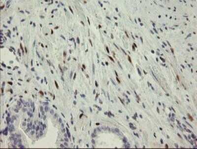 Immunohistochemistry: RBPMS Antibody (2G10) [NBP2-45551] - Analysis of Human prostate tissue.