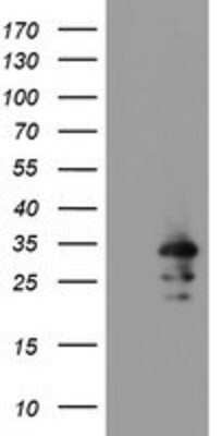 Western Blot: RBPMS Antibody (3B7) [NBP2-03905] - HEK293T cells were transfected with the pCMV6-ENTRY control (Left lane) or pCMV6-ENTRY RBPMS (Right lane) cDNA for 48 hrs and lysed. Equivalent amounts of cell lysates (5 ug per lane) were separated by SDS-PAGE and immunoblotted with anti-RBPMS.