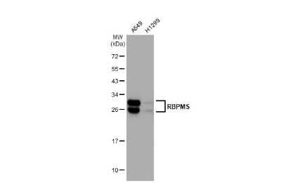 Western Blot: RBPMS Antibody (HL1105) [NBP3-13722] - Various whole cell extracts (30 ug) were separated by 12% SDS-PAGE, and the membrane was blotted with RBPMS antibody [HL1105] (NBP3-13722) diluted at 1:1000. The HRP-conjugated anti-rabbit IgG antibody (NBP2-19301) was used to detect the primary antibody.