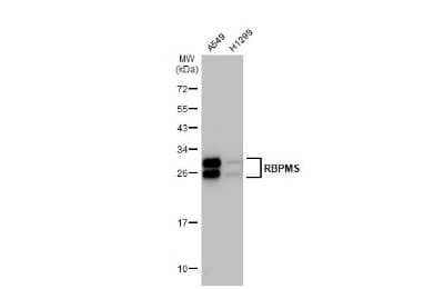 Western Blot: RBPMS Antibody (HL1106) [NBP3-13723] - Various whole cell extracts (30 ug) were separated by 12% SDS-PAGE, and the membrane was blotted with RBPMS antibody [HL1106] (NBP3-13723) diluted at 1:1000. The HRP-conjugated anti-rabbit IgG antibody (NBP2-19301) was used to detect the primary antibody.