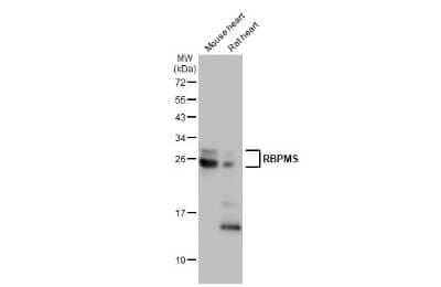 Western Blot: RBPMS Antibody (HL1106) [NBP3-13723] - Various tissue extracts (50 ug) were separated by 12% SDS-PAGE, and the membrane was blotted with RBPMS antibody [HL1106] (NBP3-13723) diluted at 1:1000. The HRP-conjugated anti-FALSE was used to detect the primary antibody.
