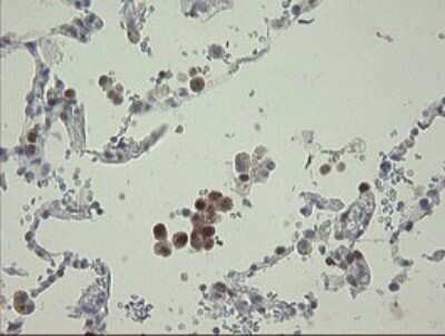 Immunohistochemistry: RBPMS Antibody (OTI2G10) - Azide and BSA Free [NBP2-73835] - Analysis of Human lung tissue.