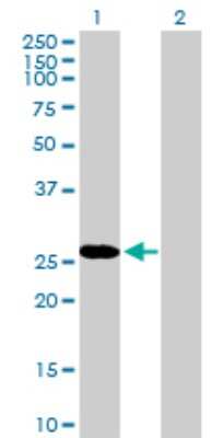 Western Blot: RBPMS Antibody [H00011030-B01P] - Analysis of RBPMS expression in transfected 293T cell line by RBPMS polyclonal antibody.  Lane 1: RBPMS transfected lysate(24.2 KDa). Lane 2: Non-transfected lysate.