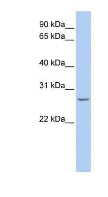 Western Blot: RBPMS Antibody [NBP1-57483] - Human Muscle lysate, concentration 0.2-1 ug/ml.