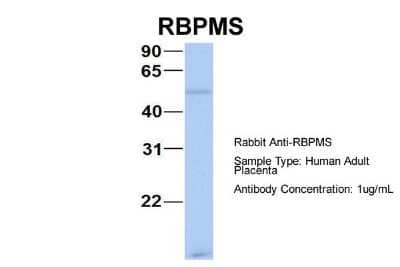 Western Blot: RBPMS Antibody [NBP1-57483] - Sample Type: Human Adult Placenta Antibody Dilution: 1.0 ug/ml