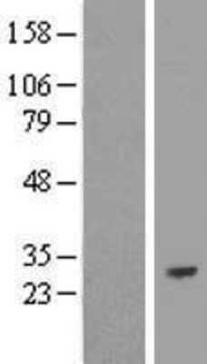 Western Blot: RBPMS Overexpression Lysate (Adult Normal) [NBL1-15235] Left-Empty vector transfected control cell lysate (HEK293 cell lysate); Right -Over-expression Lysate for RBPMS.
