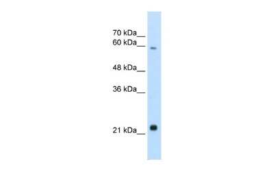 Western Blot: RBPSUHL Antibody [NBP2-84239] - WB Suggested Anti-RBPJL Antibody Titration: 2.5ug/ml. Positive Control: Jurkat cell lysate