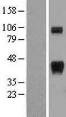 Western Blot: RCAN1 Overexpression Lysate (Adult Normal) [NBP2-04453] Left-Empty vector transfected control cell lysate (HEK293 cell lysate); Right -Over-expression Lysate for RCAN1.