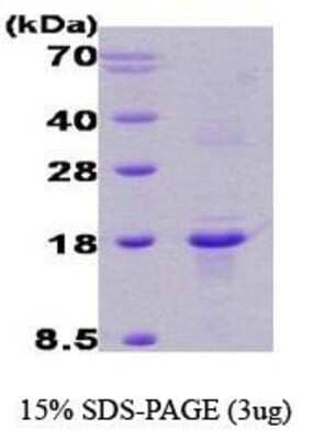 SDS-Page: RCAN1 Protein [NBC1-18339] - DSCR isoform b, 13kDa (117aa), confirmed by MALDI-TOF with a purity of 90% by SDS - PAGE