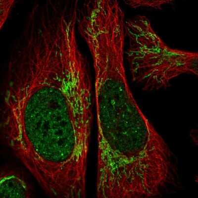 Immunocytochemistry/ Immunofluorescence RCAN2 Antibody - BSA Free
