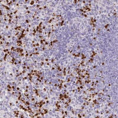 Immunohistochemistry-Paraffin: RCAN2 Antibody [NBP2-30409] - Staining of human spleen shows strong nuclear and cytoplasmic staining in red pulp of spleen.
