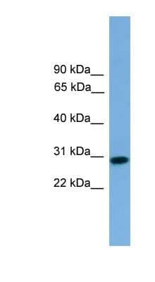 Western Blot: RCAN2 Antibody [NBP1-79477] - THP-1 cell lysate, concentration 0.2-1 ug/ml.