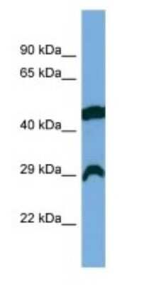 Western Blot: RCAN2 Antibody [NBP3-09305] - Western blot analysis of RCAN2 in COLO205 Whole Cell lysates. Antibody dilution at 1.0ug/ml
