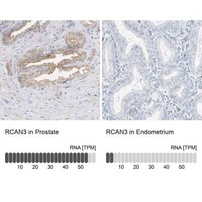 Immunohistochemistry-Paraffin RCAN3 Antibody