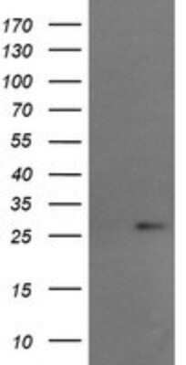 Western Blot: RCAN3 Antibody (OTI1B2) - Azide and BSA Free [NBP2-73842] - Analysis of HEK293T cells were transfected with the pCMV6-ENTRY control (Left lane) or pCMV6-ENTRY RCAN3.
