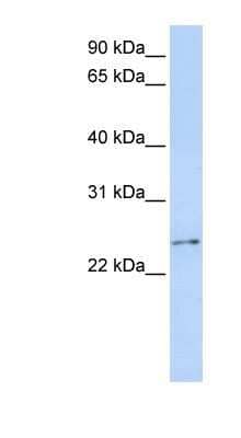 Western Blot RCAN3 Antibody