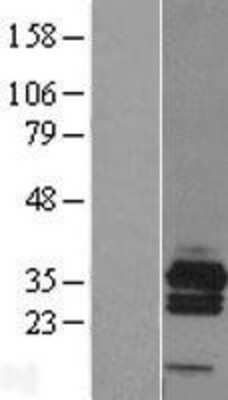 Western Blot RCAN3 Overexpression Lysate