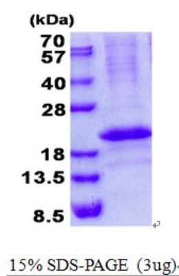 SDS-PAGE Recombinant Human RCAN3 His Protein