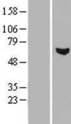 Western Blot: RCBTB1 Overexpression Lysate (Adult Normal) [NBP2-06855] Left-Empty vector transfected control cell lysate (HEK293 cell lysate); Right -Over-expression Lysate for RCBTB1.