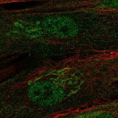 Immunocytochemistry/Immunofluorescence: RCBTB2 Antibody [NBP1-85636] - Staining of human cell line BJ shows localization to nucleus & the Golgi apparatus.