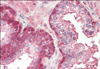 Immunohistochemistry-Paraffin RCBTB2 Antibody