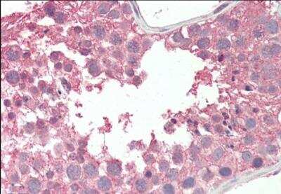 Immunohistochemistry-Paraffin RCBTB2 Antibody