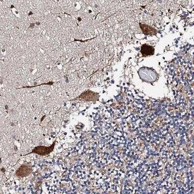 Immunohistochemistry-Paraffin: RCBTB2 Antibody [NBP1-85636] - Staining of human cerebellum shows strong cytoplasmic positivity in Purkinje cells.