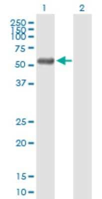 Western Blot: RCBTB2 Antibody [H00001102-B01P] - Analysis of RCBTB2 expression in transfected 293T cell line by RCBTB2 polyclonal antibody.  Lane 1: RCBTB2 transfected lysate(60.61 KDa). Lane 2: Non-transfected lysate.