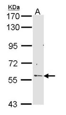 Western Blot: RCBTB2 Antibody [NBP1-33512] - Sample (30 ug of whole cell lysate) A: Hep G2 7. 5% SDS PAGE; antibody diluted at 1:1000.