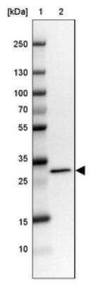 Western Blot: RCBTB2 Antibody [NBP1-85636] - Lane 1: Marker  [kDa] 250, 130, 100, 70, 55, 35, 25, 15, 10.  Lane 2: MOLT-4