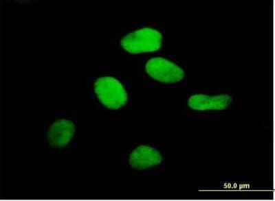 Immunocytochemistry/Immunofluorescence: RCC1 Antibody [H00001104-B01P] - Analysis of purified antibody to RCC1 on HeLa cell. (antibody concentration 10 ug/ml)