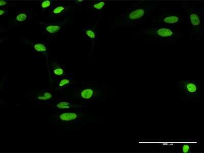 Immunocytochemistry/Immunofluorescence: RCC1 Antibody [H00001104-D01P] - Analysis of antibody to RCC1 on HeLa cell. Antibody concentration 10 ug/ml.