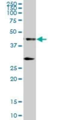 Western Blot: RCC1 Antibody [H00001104-B01P] - Analysis of RCC1 expression in human colon.