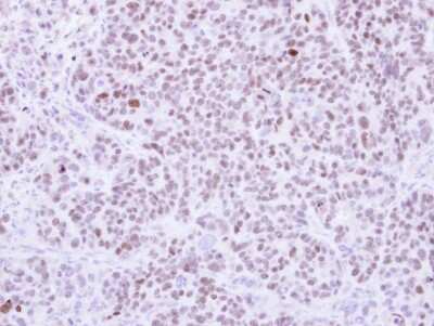 Immunohistochemistry-Paraffin: RCC2 Antibody [NBP1-32602] -  SW480 xenograft, using RCC2 antibody at 1:500 dilution. Antigen Retrieval: Citrate buffer, pH 6.0, 15 mi.
