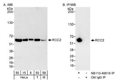 Western Blot: RCC2 Antibody [NB110-40619] - Detection of Human and Mouse RCC2 on HeLa whole cell lysate using NB110-40619. RCC2 was immunoprecipitated by rabbit anti-RCC2 antibody NB110-40618.