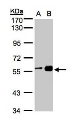 Western Blot: RCC2 Antibody [NBP1-32602] - Sample(30 ug whole cell lysate)A:H1299B:MOLT4  7. 5% SDS PAGE, antibody diluted at 1:1000.