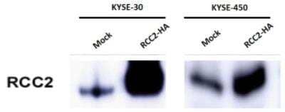 Western Blot: RCC2 Antibody [NBP1-32602] - KYSE-30 and KYSE-450 human esophageal cancer cells were transfected with a RCC2 over-expression plasmid or mock and RCC2 expression was detected by Western Blot. WB image submitted by a verified customer review.