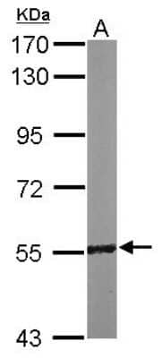 Western Blot: RCC2 Antibody [NBP2-20118] - Sample (50 ug of whole cell lysate) A: Mouse Brain, 7. 5% SDS PAGE gel, diluted at 1:1000.