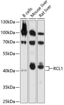 Western Blot: RCL1 Antibody [NBP2-94892] - Analysis of extracts of various cell lines, using RCL1 at 1:1000 dilution. Secondary antibody: HRP Goat Anti-Rabbit IgG (H+L) at 1:10000 dilution. Lysates/proteins: 25ug per lane. Blocking buffer: 3% nonfat dry milk in TBST. Detection: ECL Basic Kit . Exposure time: 10s.