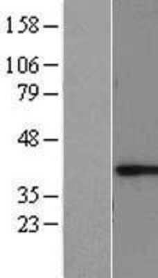 Western Blot: RCN1 Overexpression Lysate (Adult Normal) [NBL1-15246] Left-Empty vector transfected control cell lysate (HEK293 cell lysate); Right -Over-expression Lysate for RCN1.