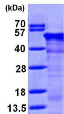 Western Blot: RCN1 Protein [NBP1-45321] - 15% SDS-PAGE (3ug)